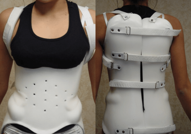 Choosing the Perfect Back Brace for Scoliosis