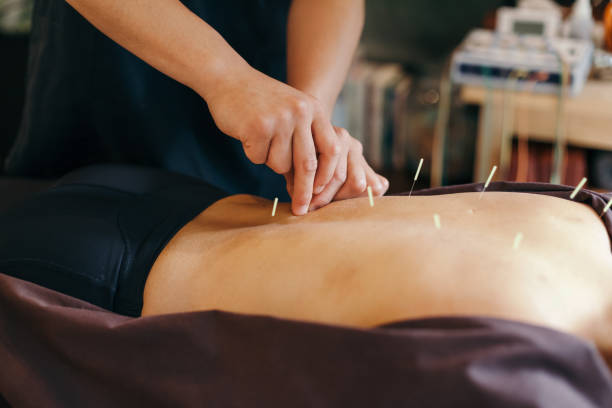 Acupuncture for Weight Loss: How It Works and Why It’s Effective