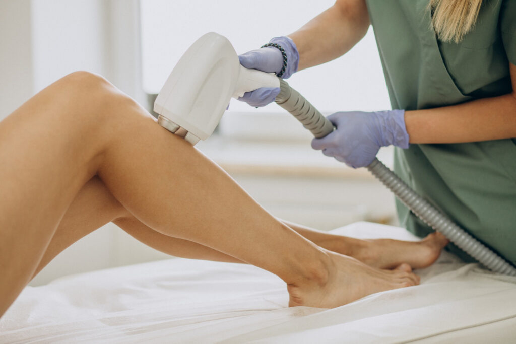 IPL hair removal