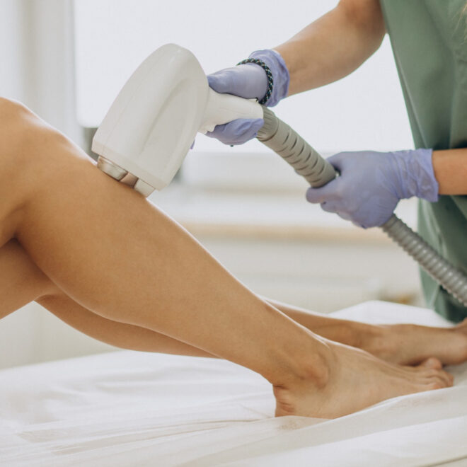 5 Factors to Consider Before Getting IPL Hair Removal