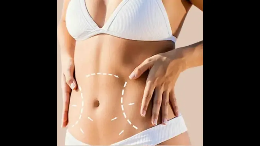 Exploring the Latest Techniques in Full Body Liposuction Surgery in Dubai