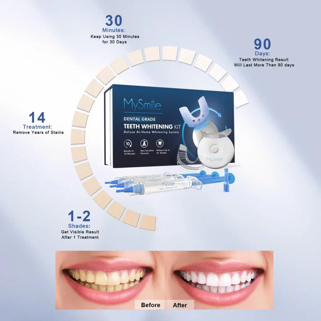 My Smile Teeth Whitening Kit