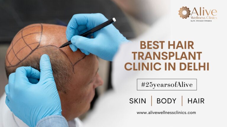 Alive Wellness Clinics – Premier Hair Transplant & Dermatology Services in Delhi