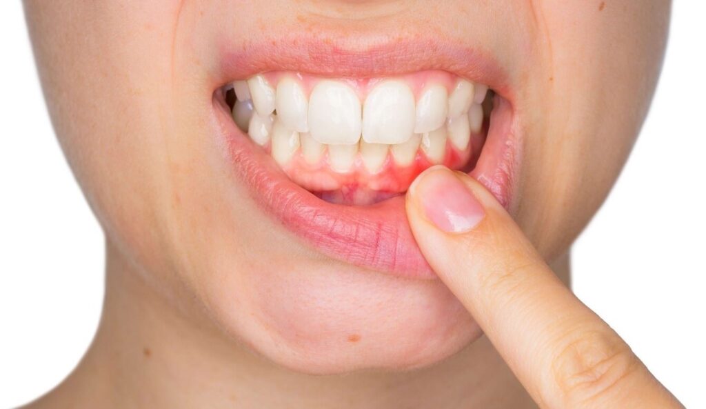 Gum Disease Treatment Dentist