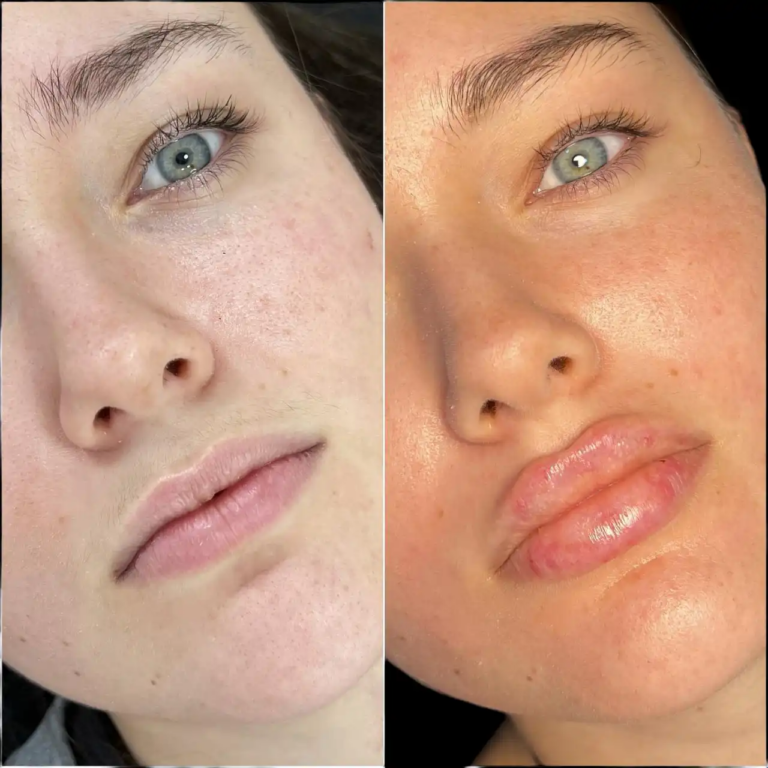 Achieving Facial Harmony with Juvederm: Insights from the Best Aesthetic Clinics in dubai