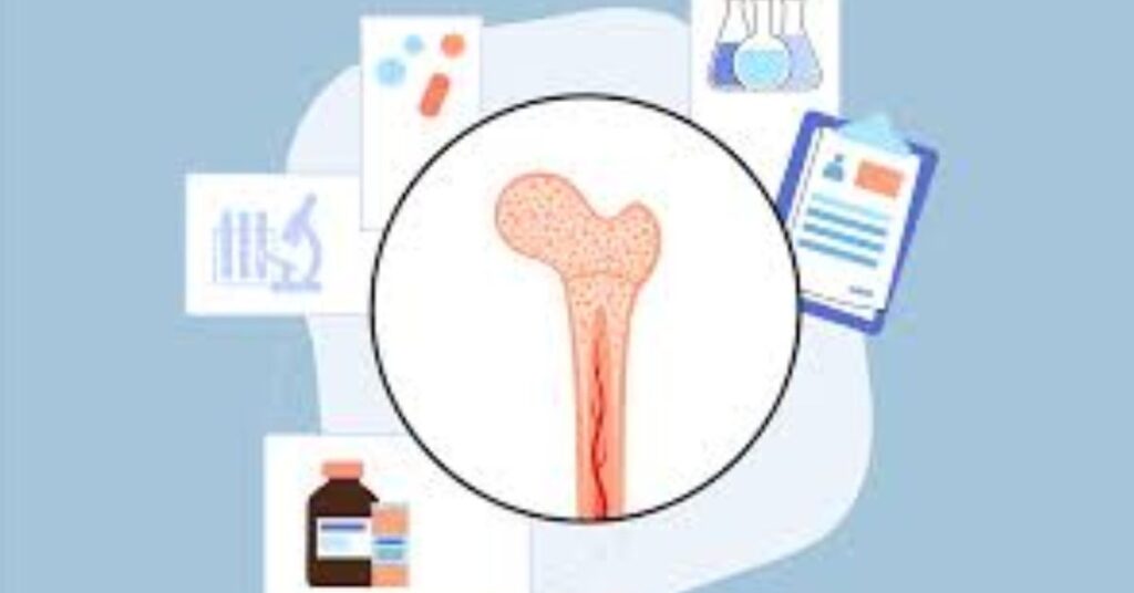 Bone Marrow Transplants