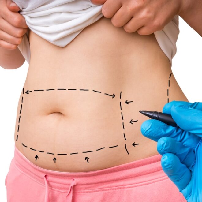 How Tummy Tuck in Dubai is Revolutionizing Body Image for Both Men and Women