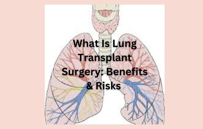 What Is Lung Transplant Surgery: Benefits & Risks