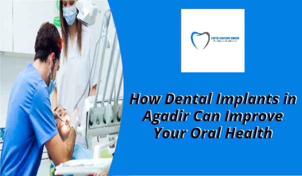 Dental Implant in Agadir