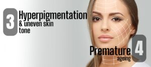 Pigmentation