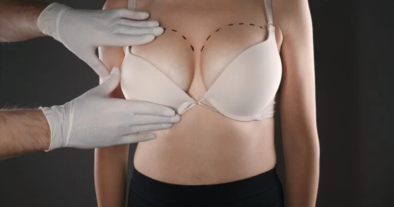 Best Breast Augmentation Surgeons in Dubai: What Makes Them Experts in the Field