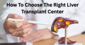 How to Choose the Right Liver Transplant Center