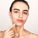 Which Acne Scar Is Hardest to Treat?