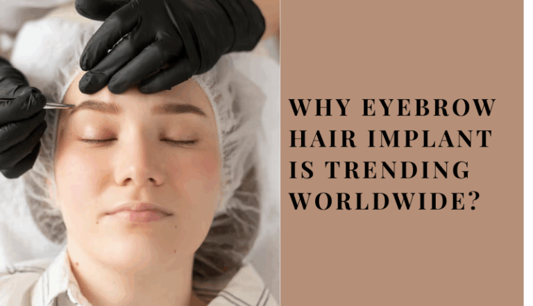 Why Eyebrow Hair Implant Is Trending Worldwide?