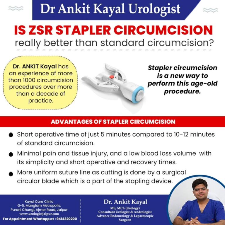 Is ZSR Circumcision Safe? A Complete Guide to Risks and Benefits