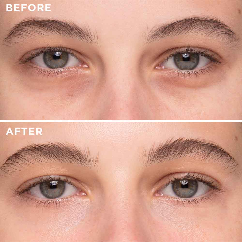Instant Eye Lift