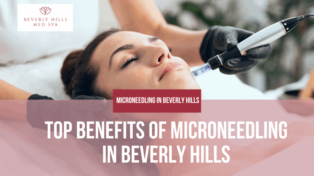 Microneedling in Beverly Hills