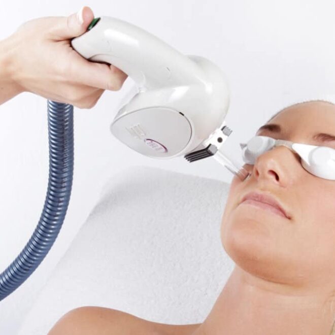 What is the Best Type of Laser Treatment?