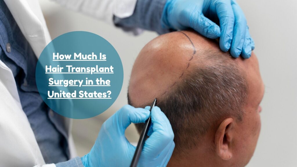 how much is hair transplant surgery