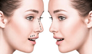 Top Clinics for Nose Fillers in Dubai: What You Need to Know
