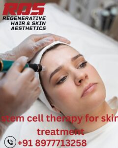 Is Stem Cell Therapy the Future of Skincare? An In-Depth Look