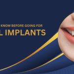 All you need to know before going for dental implants
