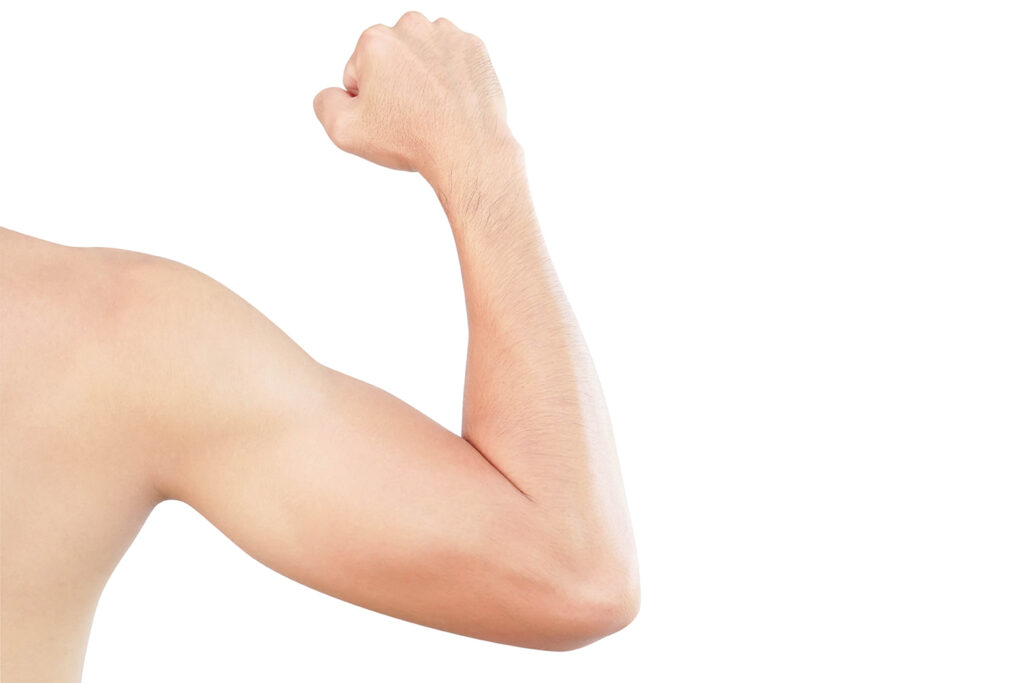 Arm Lift Surgery in Dubai