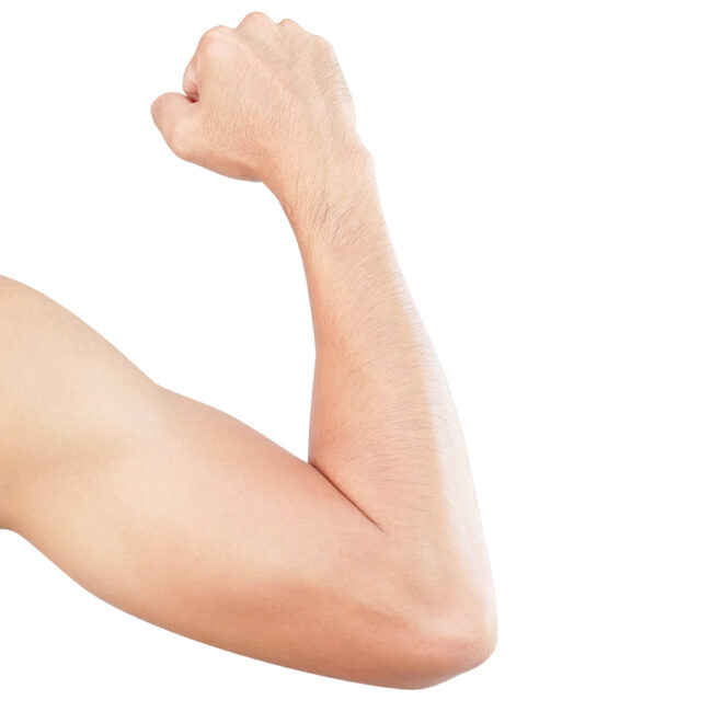 Why Are More Men Choosing Arm Lift Surgery Today?