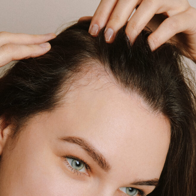 The Benefits of Seeking Hair Loss Solutions for Women in Dallas