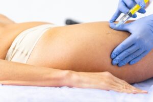Top Body Filler Injections in Dubai: Dynamic Aesthetic Clinic