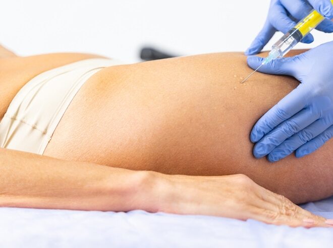 Top Body Filler Injections in Dubai: Dynamic Aesthetic Clinic