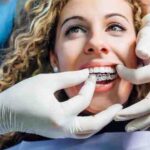 Why Fixed Tooth Restorations Are Popular in Blackpool