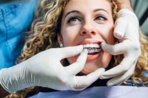 Why Fixed Tooth Restorations Are Popular in Blackpool