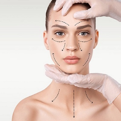 Facelift Recovery Timeline: What You Need to Know
