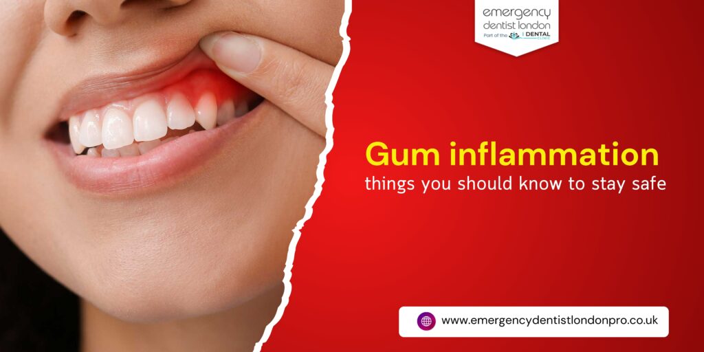 Gum inflammation – things you should know to stay safe