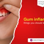 Gum inflammation – things you should know to stay safe