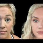 What Makes Botox at the Best Aesthetic Clinic in dubai Truly Exceptional