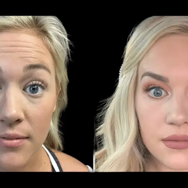 First-Timer’s Guide to Botox in Dubai: What to Expect and Ask Before You Book