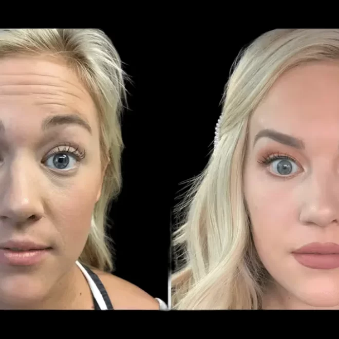 What Makes Botox at the Best Aesthetic Clinic in dubai Truly Exceptional
