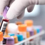 Best Home Blood Collection Services in Guwahati: Trusted Lab Testing at Home