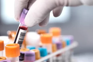 Best Home Blood Collection Services in Guwahati: Trusted Lab Testing at Home