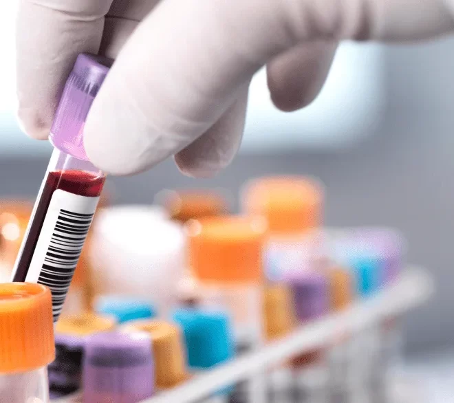 Best Home Blood Collection Services in Guwahati: Trusted Lab Testing at Home