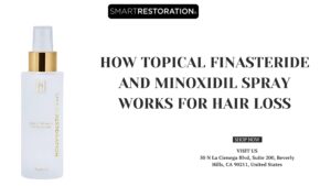 How Topical Finasteride and Minoxidil Spray Works for Hair Loss
