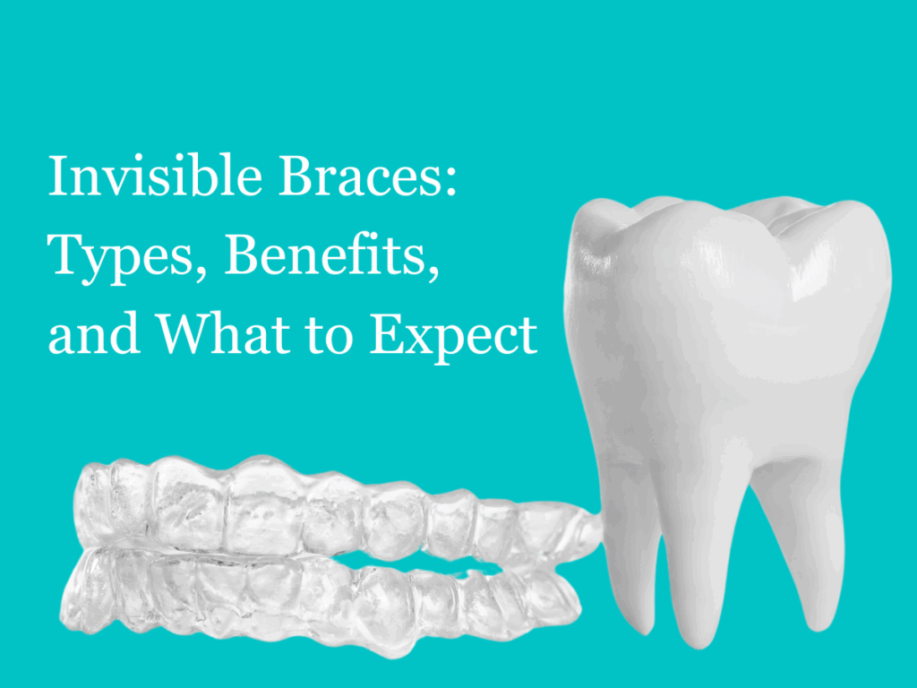 Types & Benefits of Invisible Braces