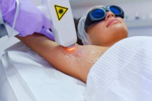 Say Goodbye to Unwanted Hair: Laser Hair Removal Near Edmonton