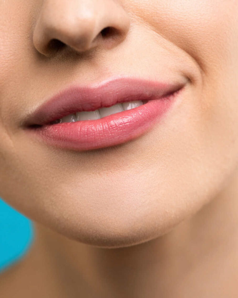 What Are the Side Effects of Lip Augmentation?
