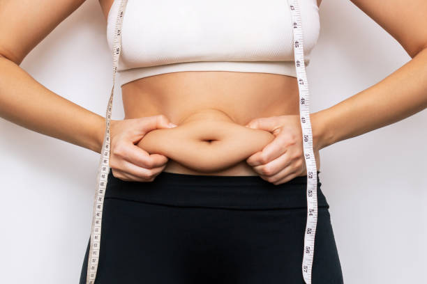 Liposuction in Riyadh