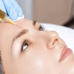 What to Know Before Getting Microneedling in Islamabad