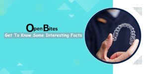 Open Bites: Get To Know Some Interesting Facts