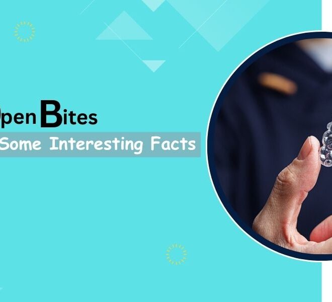 Open Bites: Get To Know Some Interesting Facts